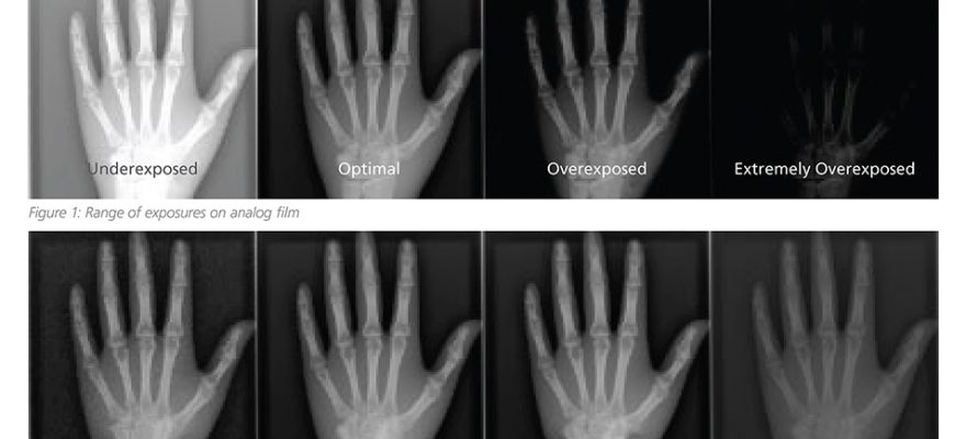 Images comparing analog and digital exposures