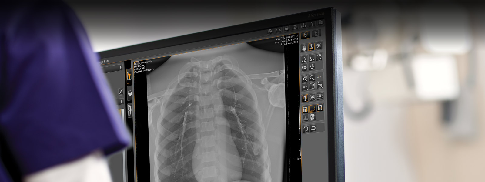 kodak dental imaging software viewer download free
