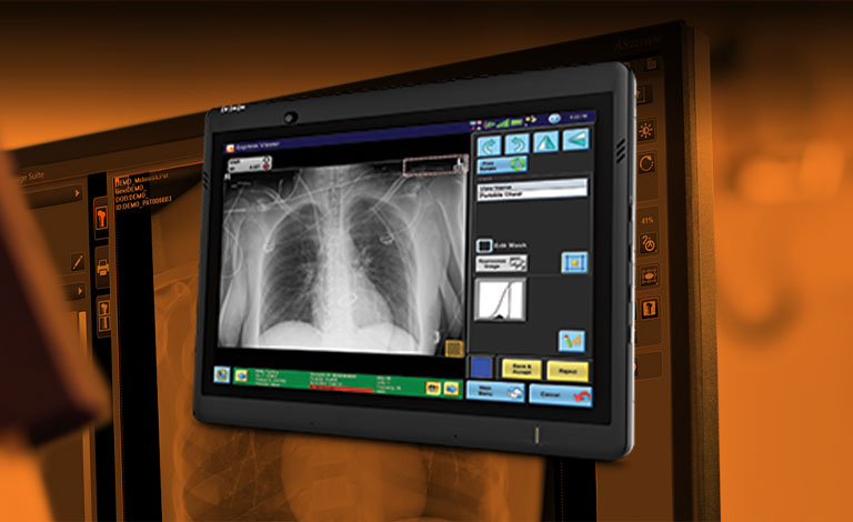 Carestream lança uma nova atualização de software para reforçar a precisão diagnóstica