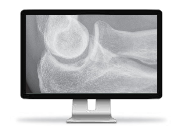 Quality Solutions Built to Address Real Voice of Customer Needs