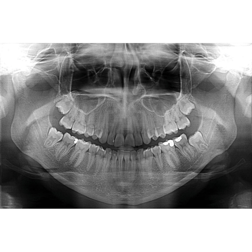 VITA Flex CR Dental Panoramic Kit